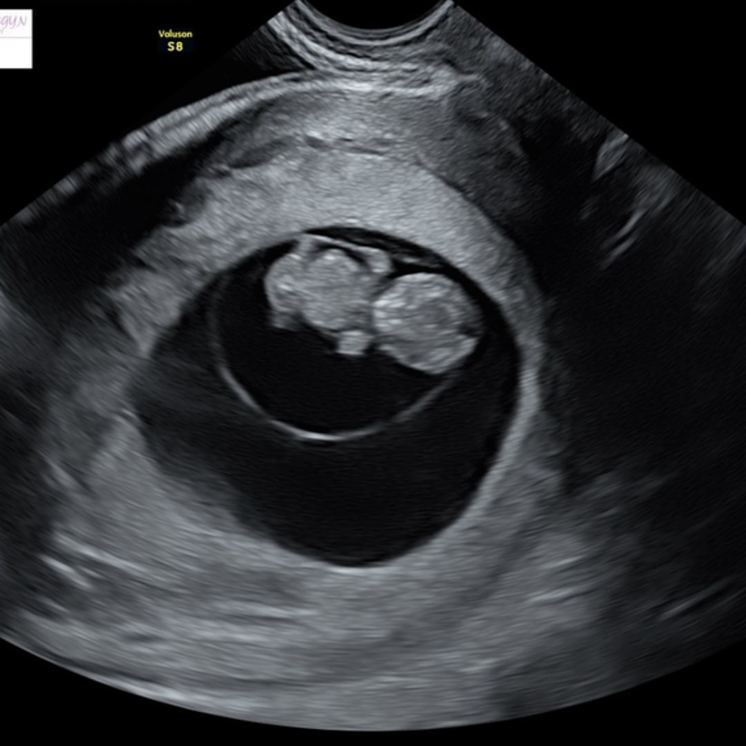 Photo shared by Heaven for their Babylist baby registry.