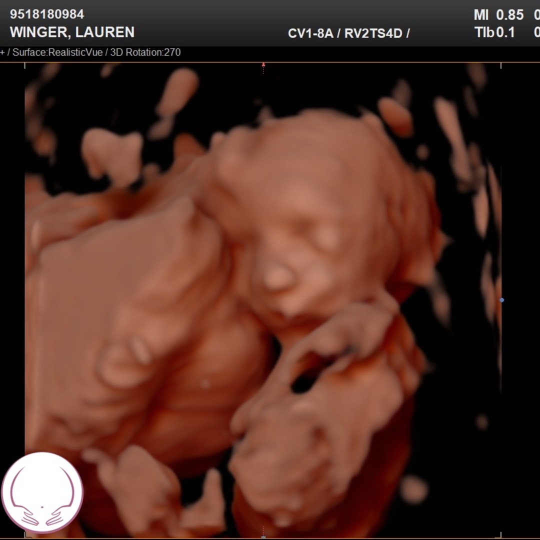 Photo shared by Lauren for their Babylist baby registry.