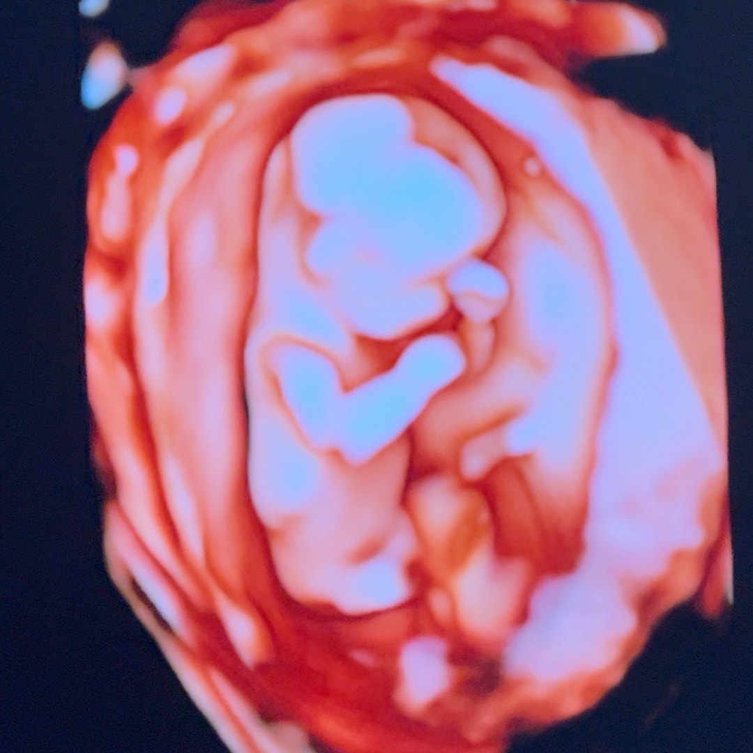 Photo shared by Mallory for their Babylist baby registry.