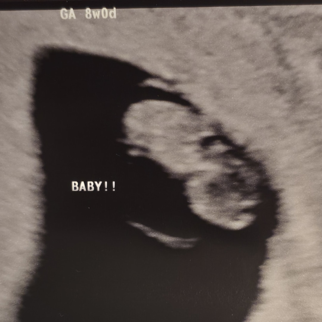 Photo shared by Rebecca for their Babylist baby registry.