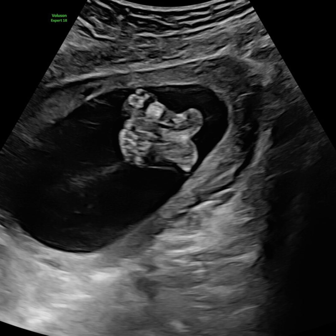 Photo shared by Bayli for their Babylist baby registry.