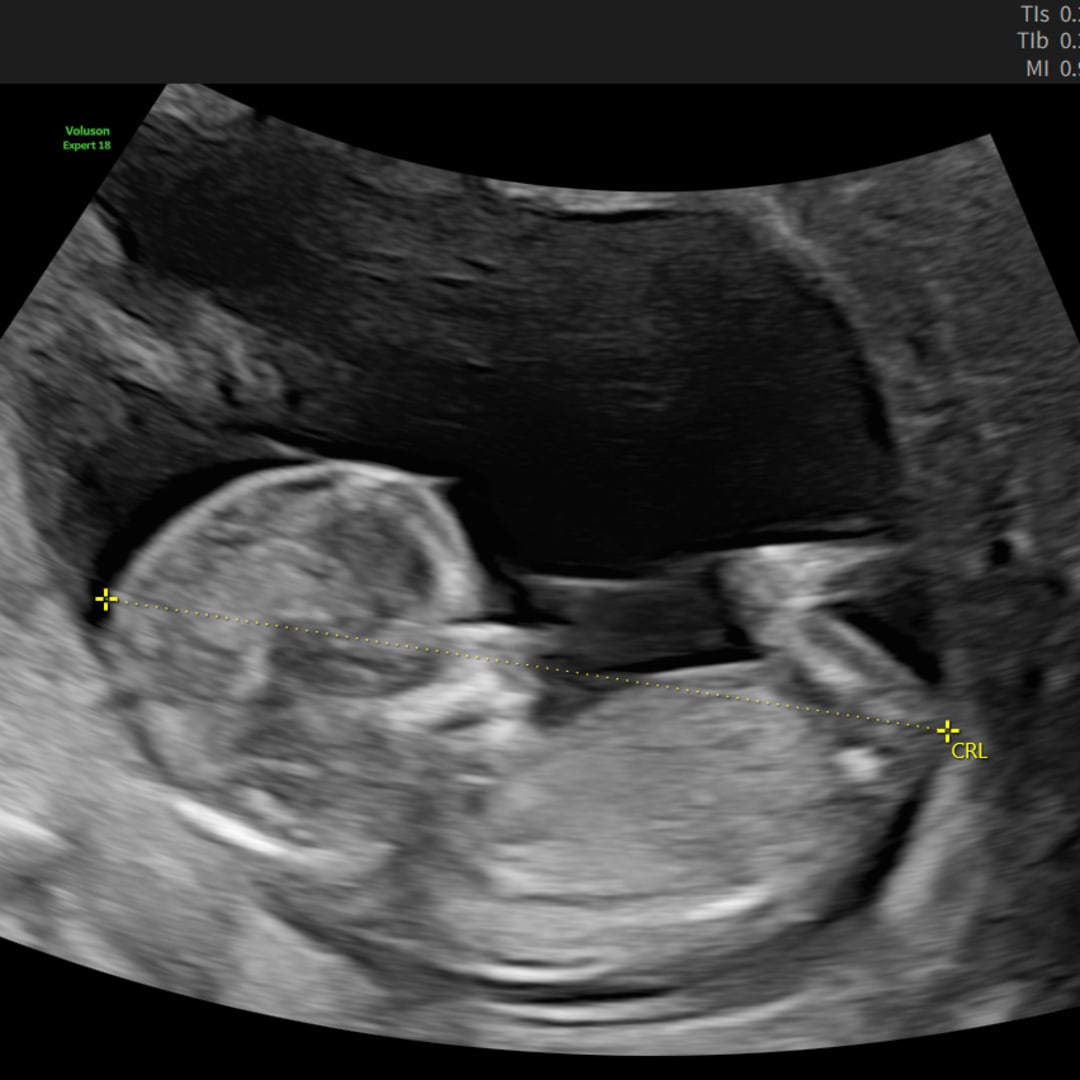 Photo shared by Courtney for their Babylist baby registry.