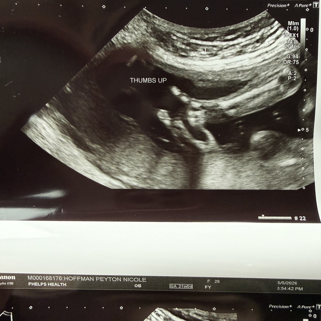 Photo shared by Peyton for their Babylist baby registry.