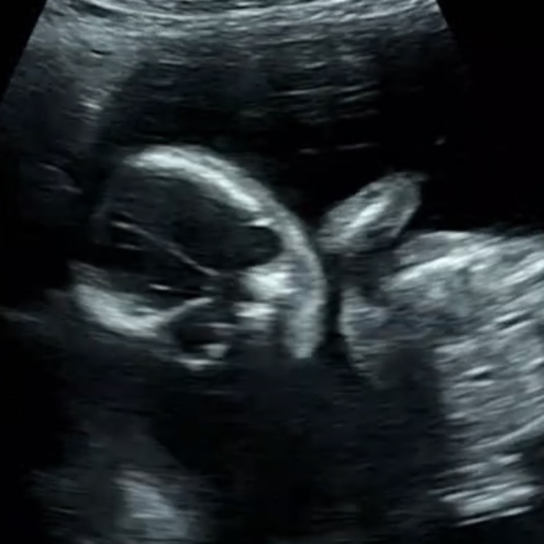 Photo shared by Claire for their Babylist baby registry.
