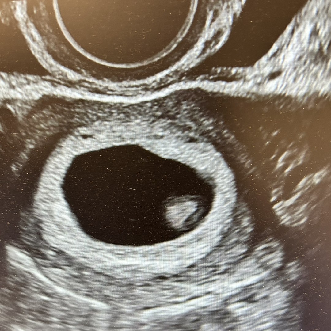 Photo shared by Claire for their Babylist baby registry.