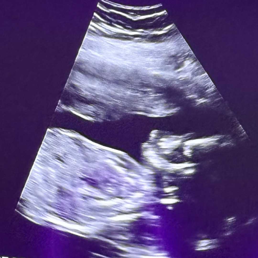 Photo shared by Kalina for their Babylist baby registry.