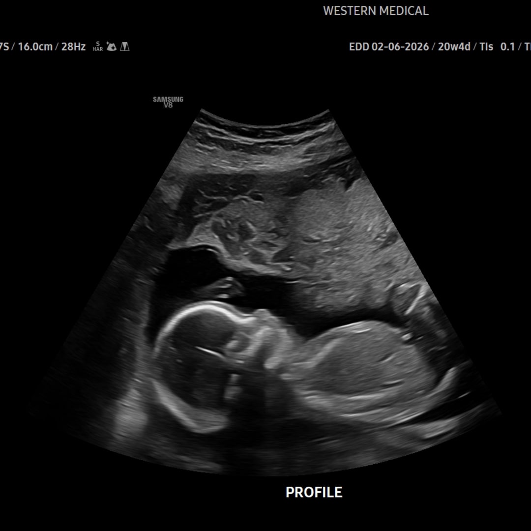 Photo shared by Kiler for their Babylist baby registry.