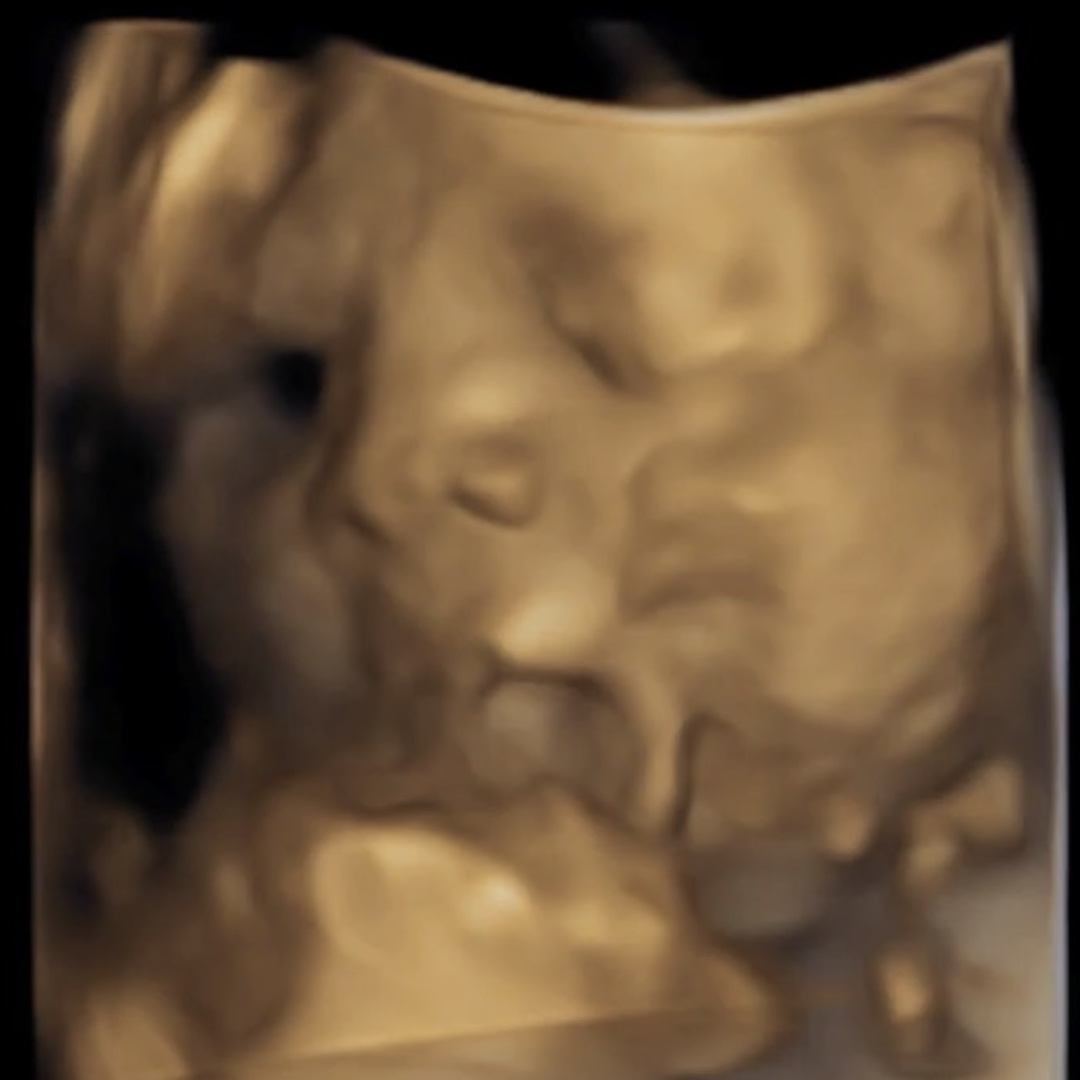 Photo shared by Christine for their Babylist baby registry.