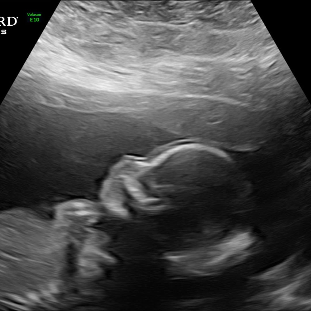 Photo shared by Allison for their Babylist baby registry.