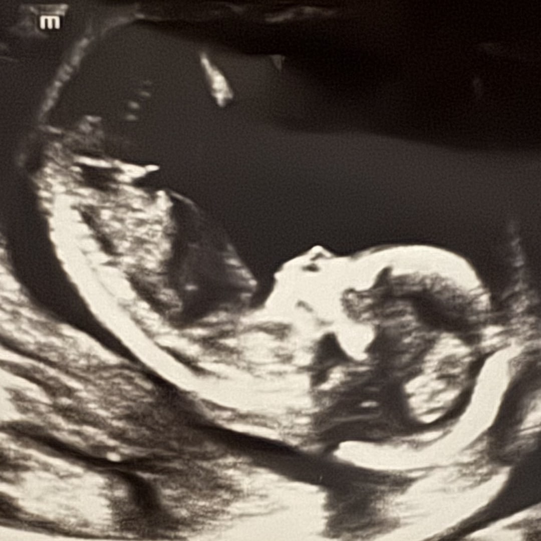 Photo shared by Keyanni for their Babylist baby registry.