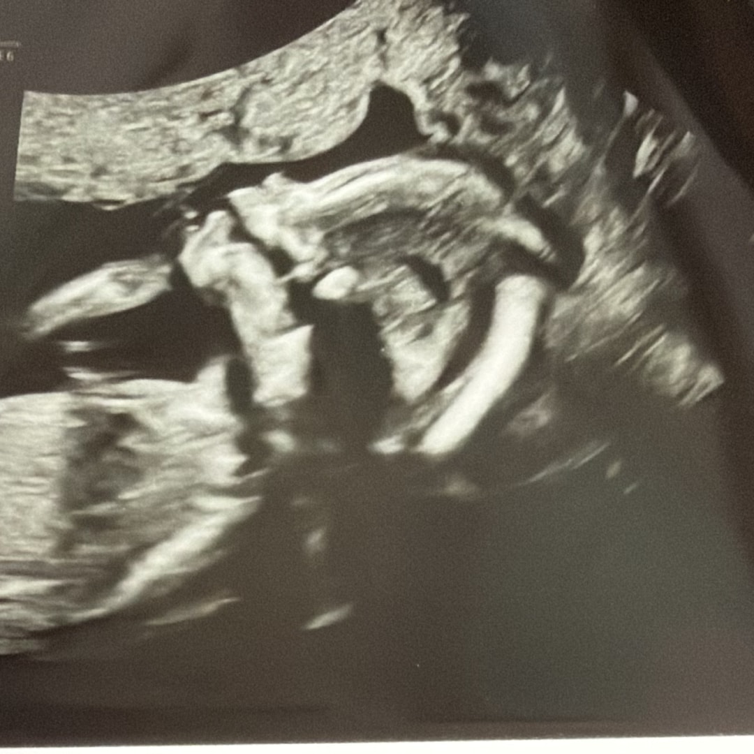 Photo shared by Emma for their Babylist baby registry.