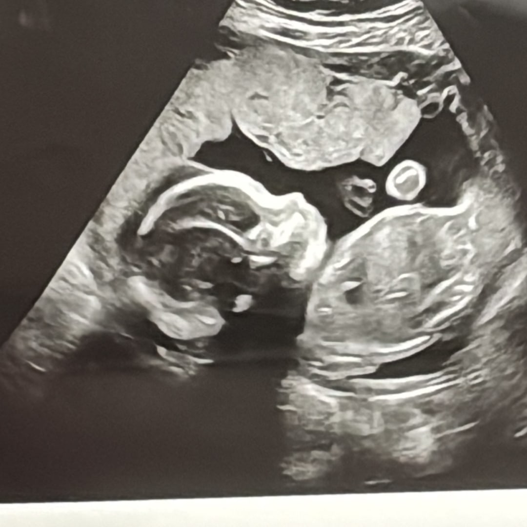 Photo shared by Daniela for their Babylist baby registry.