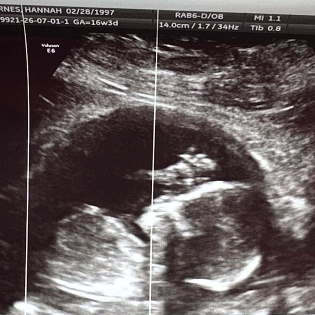 Photo shared by Hannah for their Babylist baby registry.