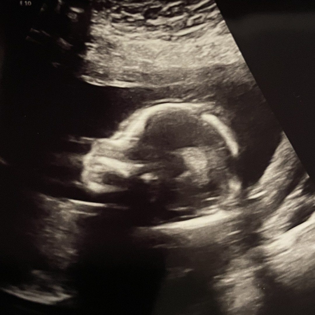 Photo shared by Hilary for their Babylist baby registry.