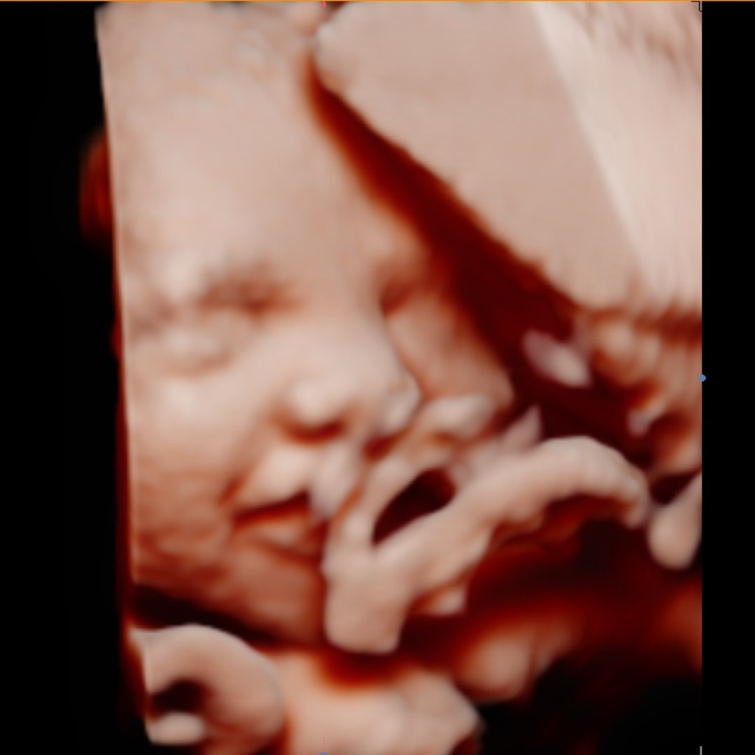 Photo shared by Cinthia for their Babylist baby registry.