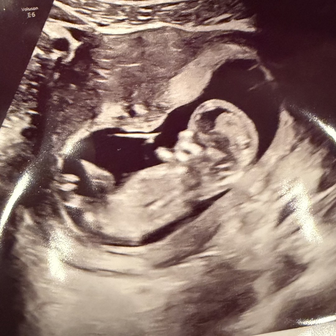 Photo shared by Deanna for their Babylist baby registry.