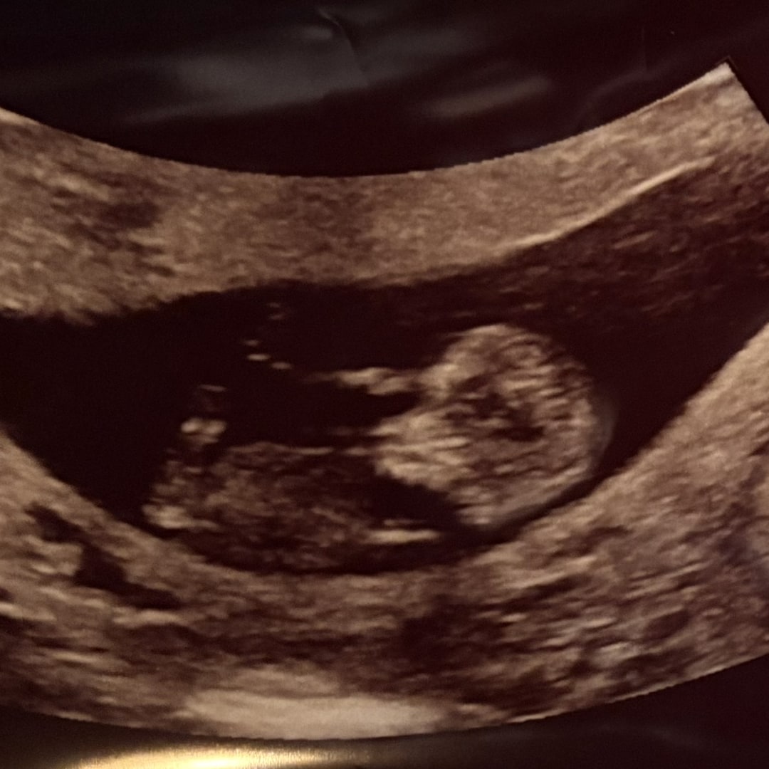 Photo shared by Amilia for their Babylist baby registry.