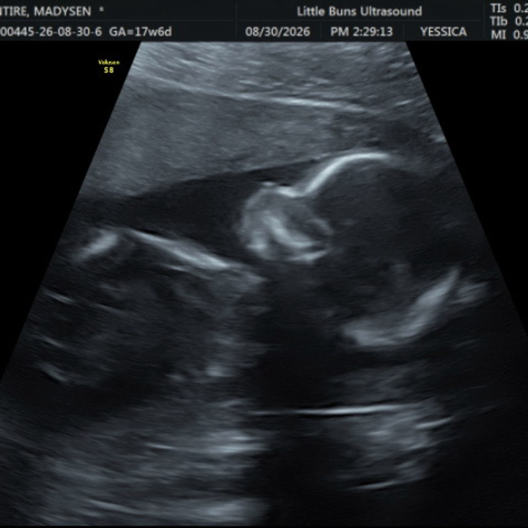 Photo shared by Maddie for their Babylist baby registry.