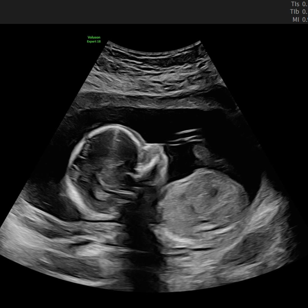 Photo shared by Zoe for their Babylist baby registry.