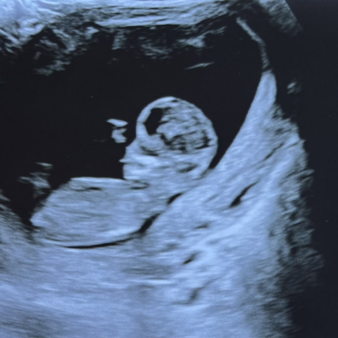 Photo shared by Kaori for their Babylist baby registry.