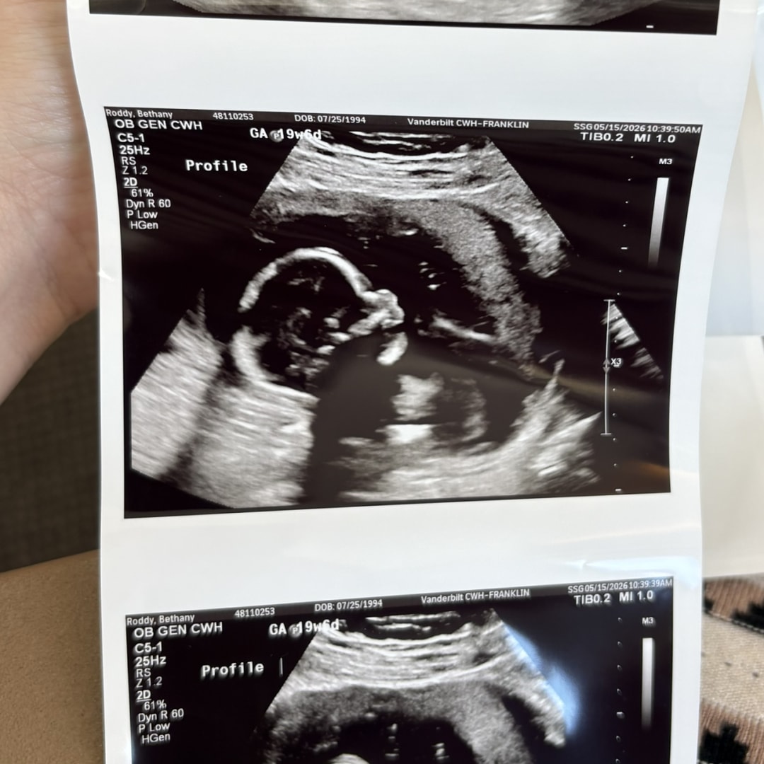 Photo shared by Bethany for their Babylist baby registry.