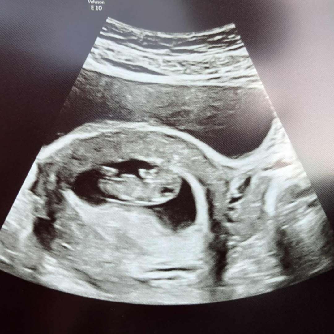 Photo shared by Maude Mc for their Babylist baby registry.