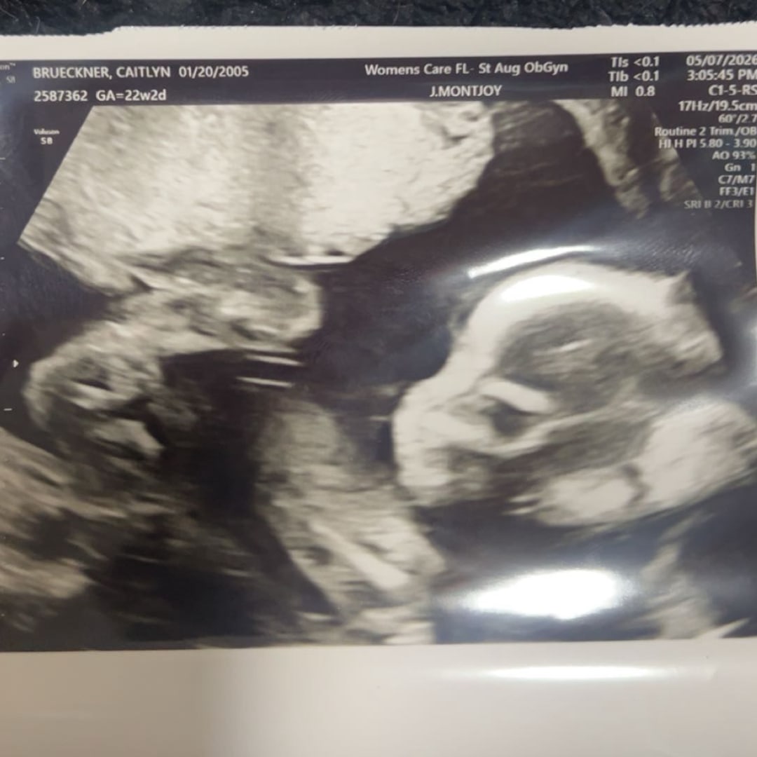 Photo shared by Caitlyn for their Babylist baby registry.
