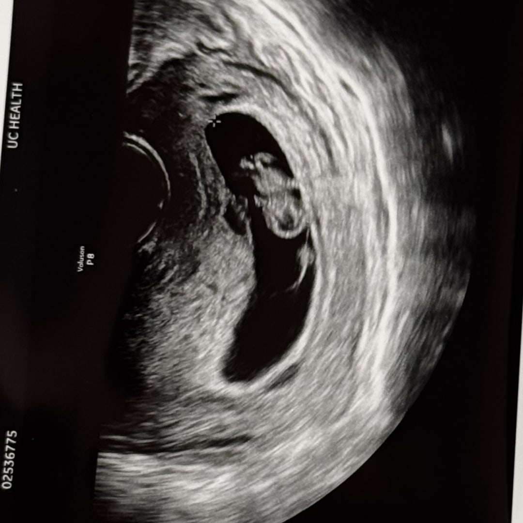 Photo shared by Ariel for their Babylist baby registry.