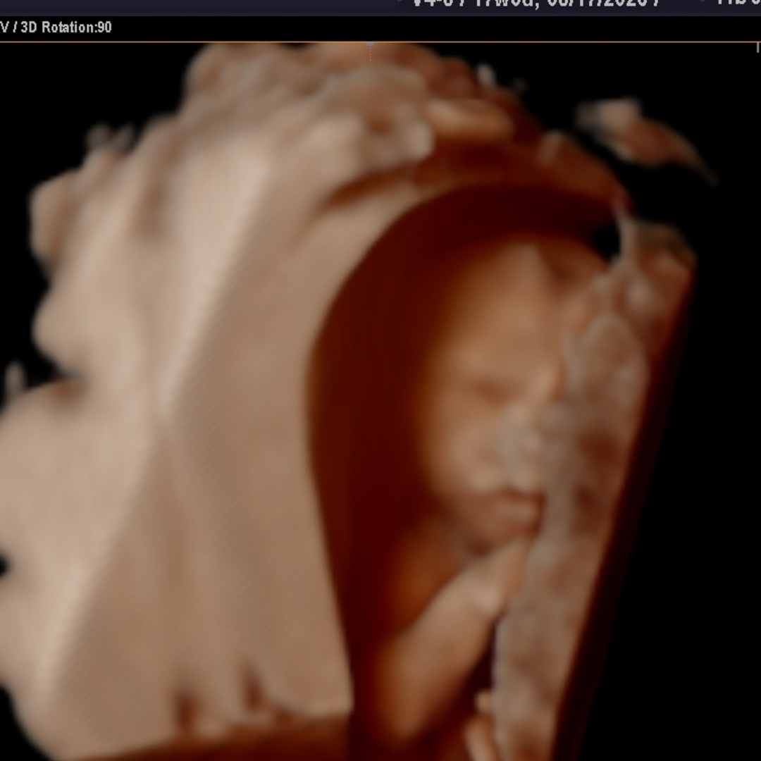 Photo shared by Alivia for their Babylist baby registry.