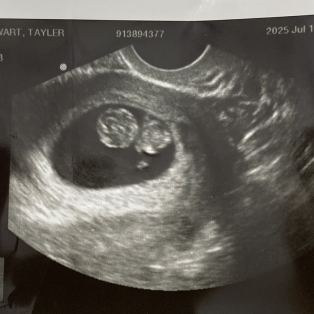 Photo shared by Tayler for their Babylist baby registry.