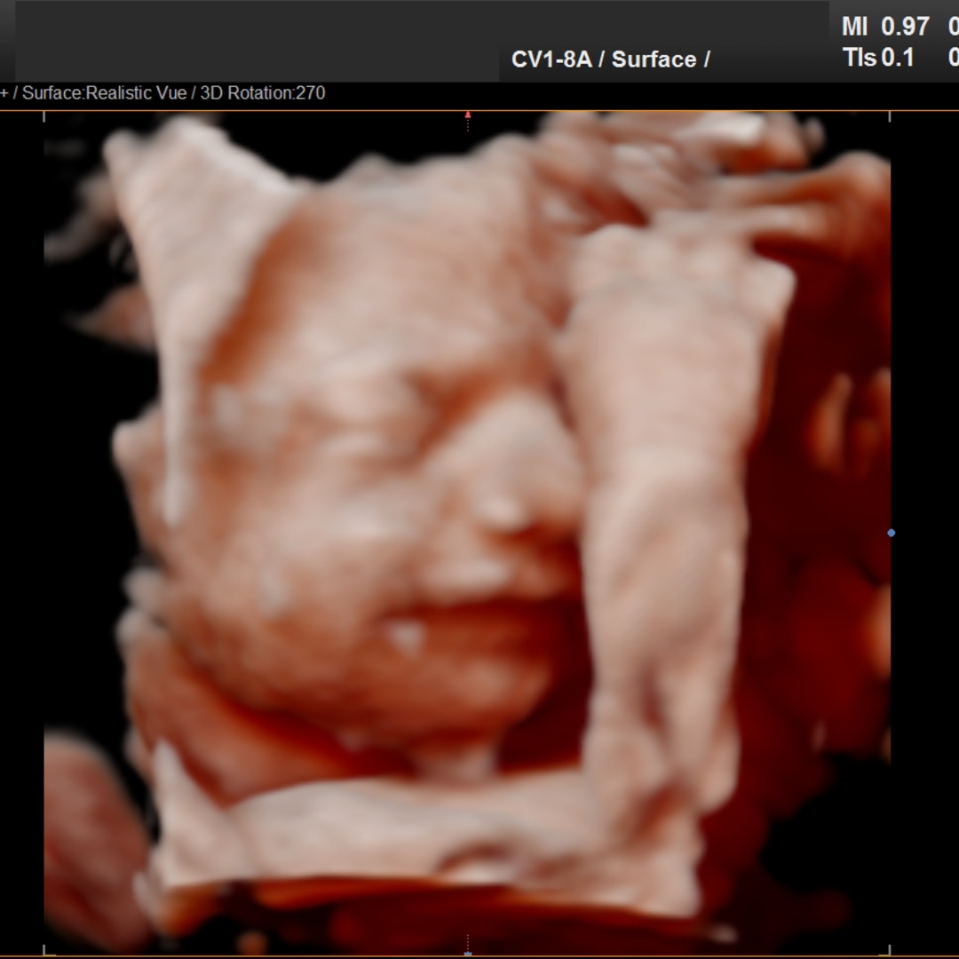 Photo shared by Angela for their Babylist baby registry.