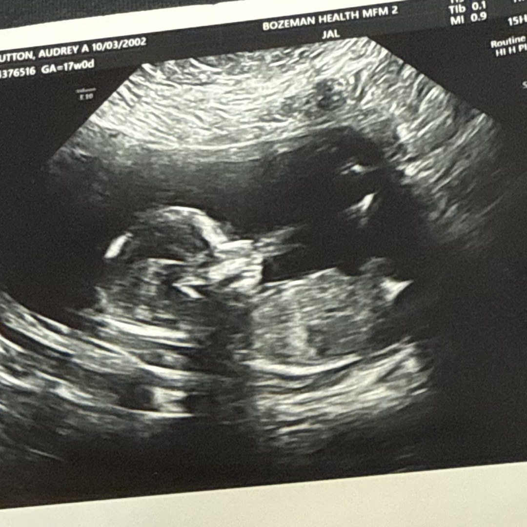 Photo shared by Audrey for their Babylist baby registry.