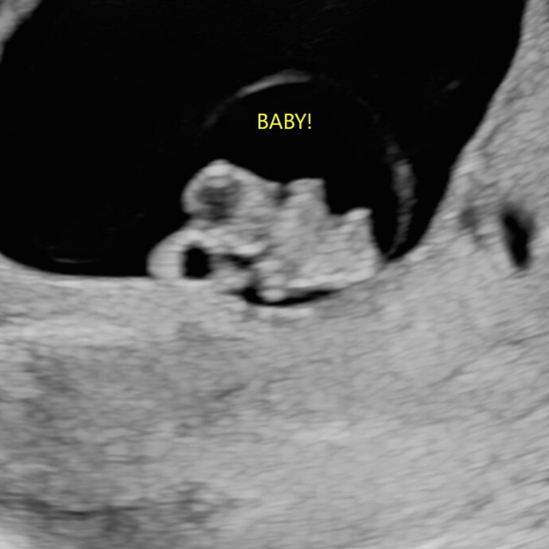Photo shared by Ashley for their Babylist baby registry.
