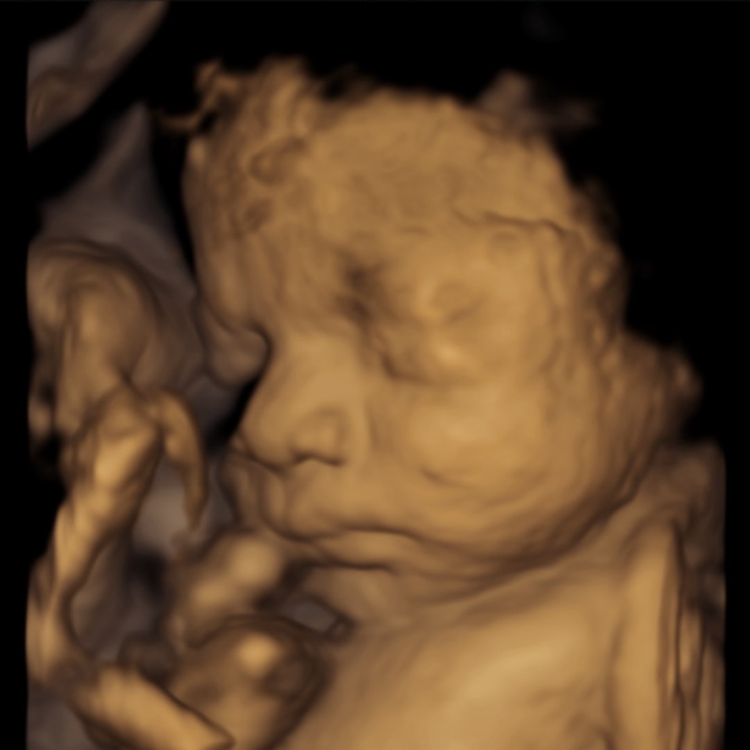 Photo shared by Briana for their Babylist baby registry.