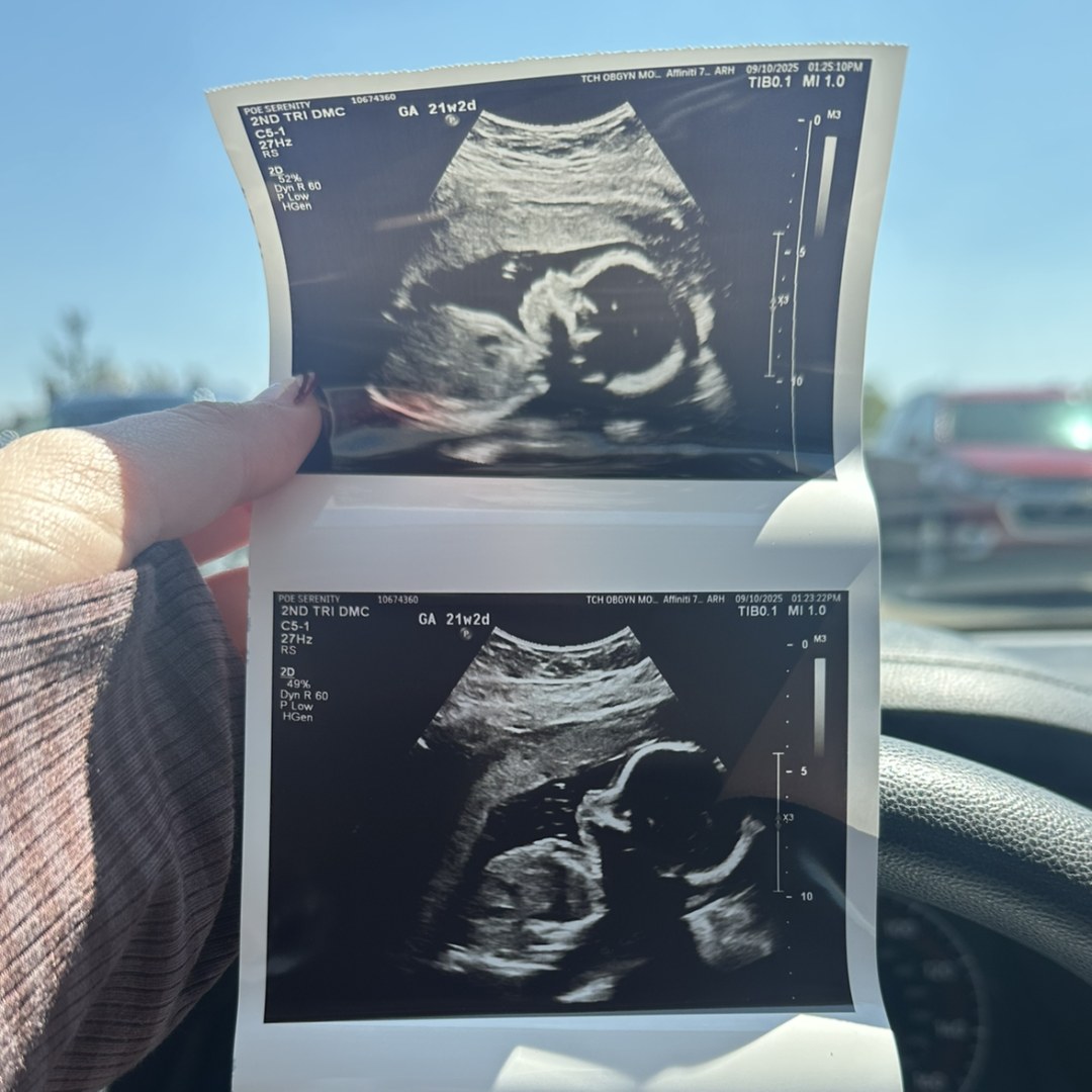 Photo shared by Serenity for their Babylist baby registry.