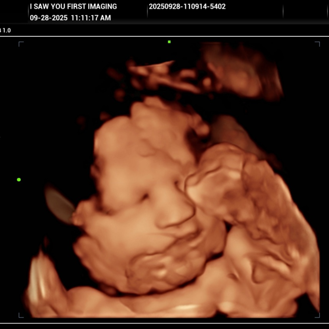 Photo shared by Alanna for their Babylist baby registry.