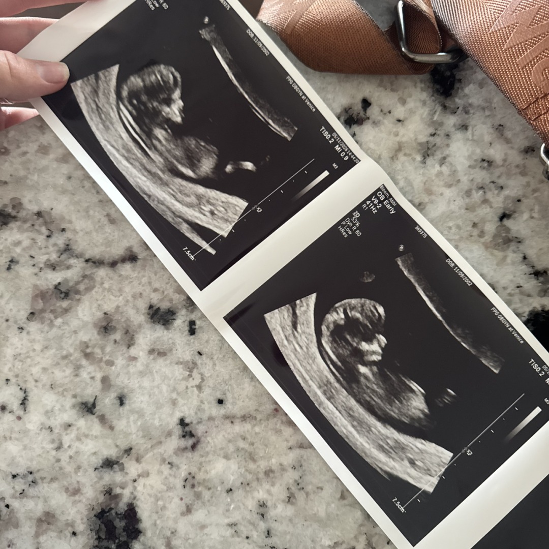 Photo shared by Abbi for their Babylist baby registry.