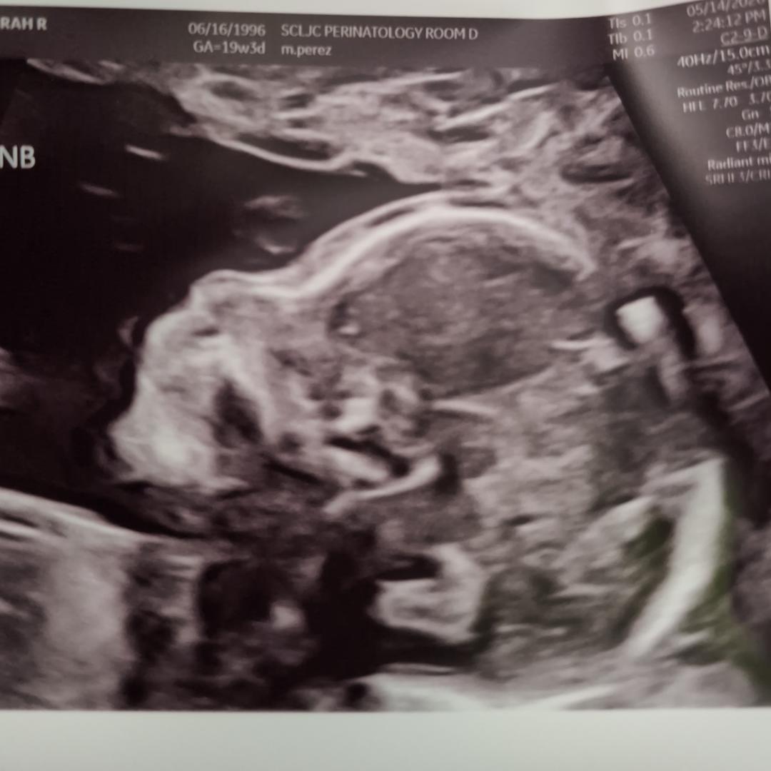 Photo shared by Sarah for their Babylist baby registry.