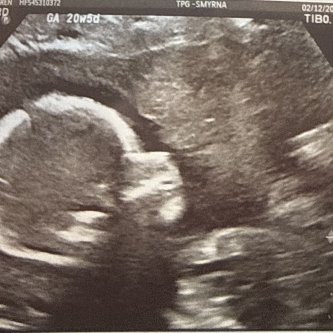 Photo shared by Karen for their Babylist baby registry.