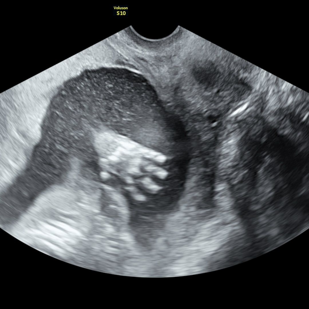 Photo shared by Hailie for their Babylist baby registry.