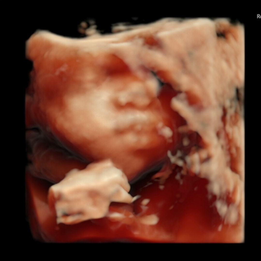 Photo shared by Esyence for their Babylist baby registry.