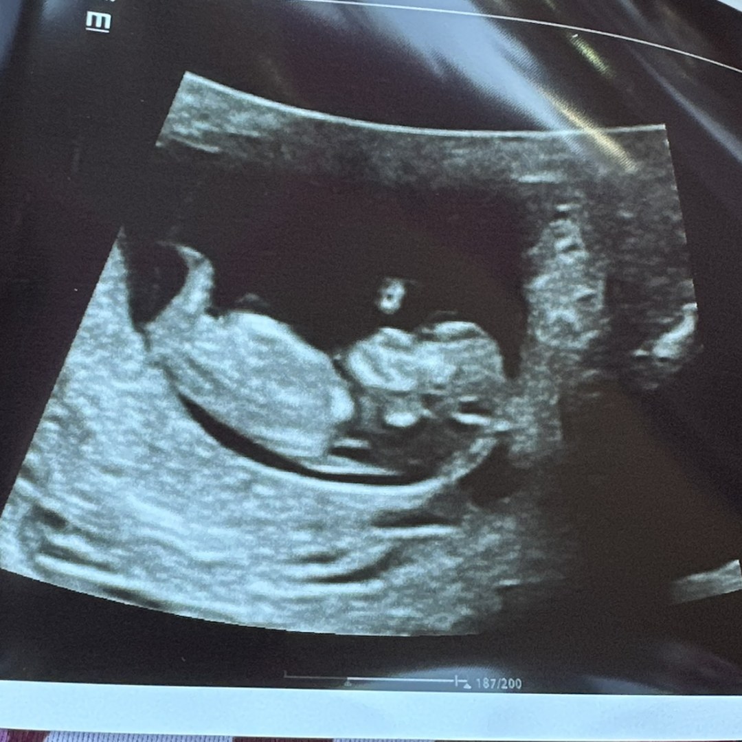 Photo shared by Joselin for their Babylist baby registry.