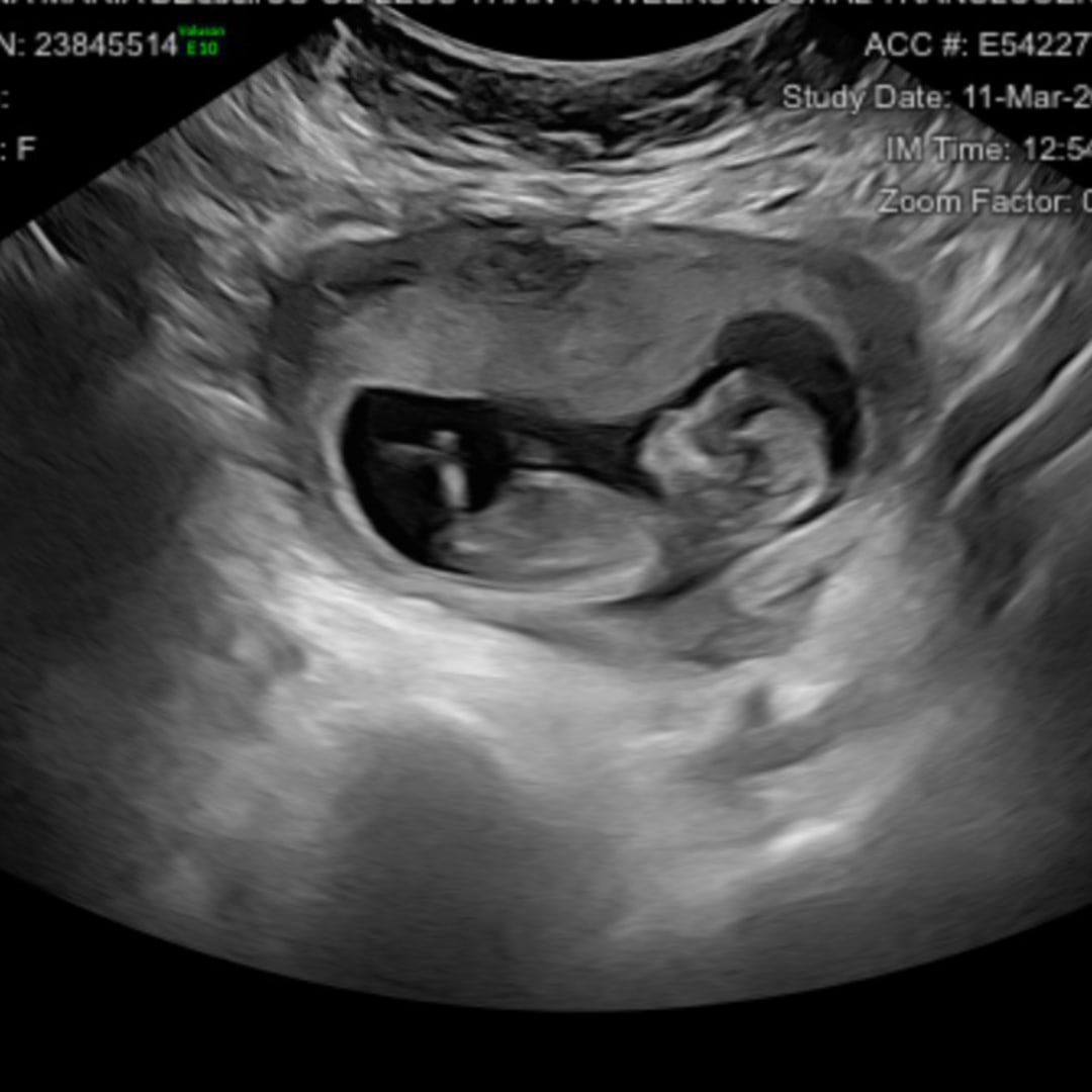 Photo shared by Annamaria for their Babylist baby registry.