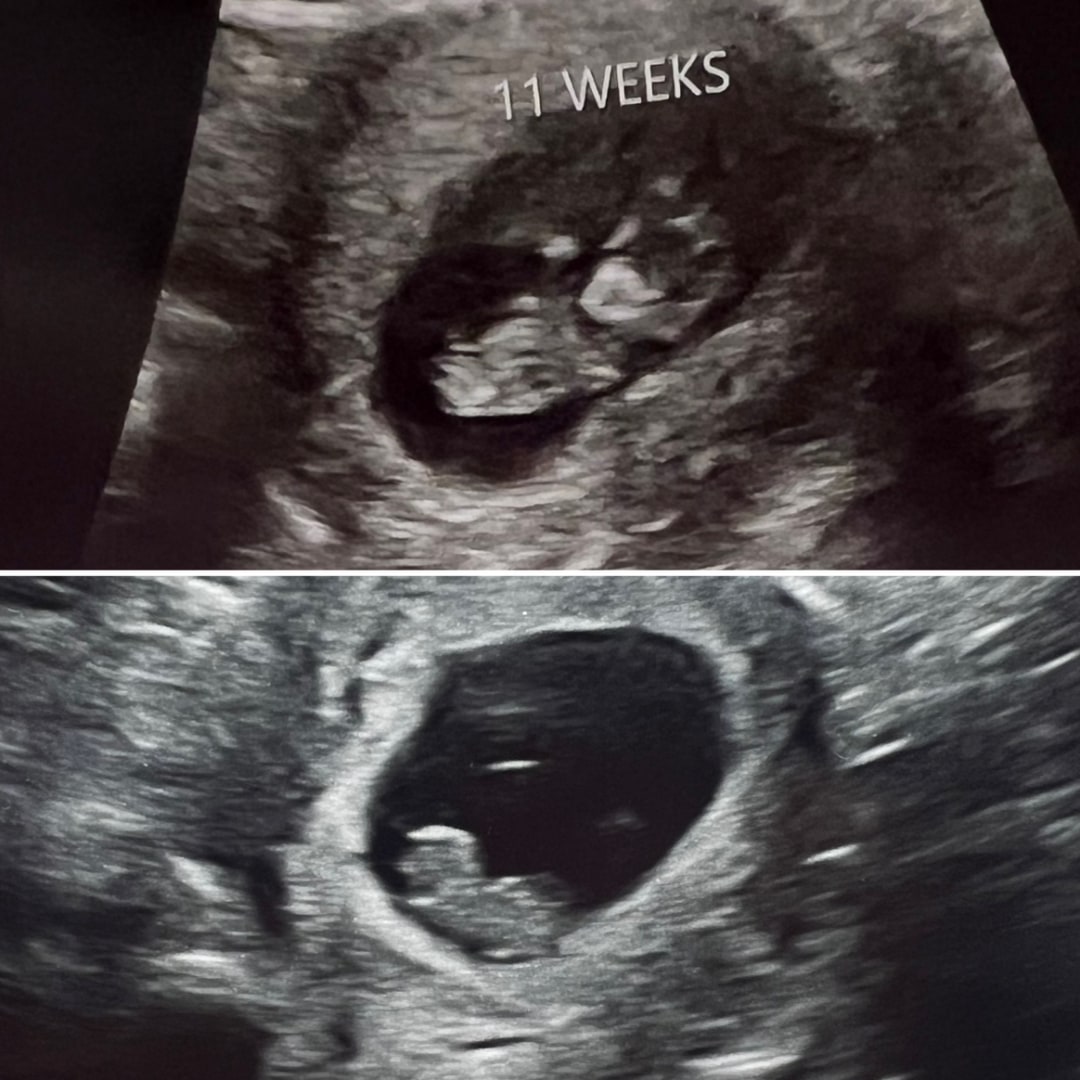 Photo shared by Emalee for their Babylist baby registry.