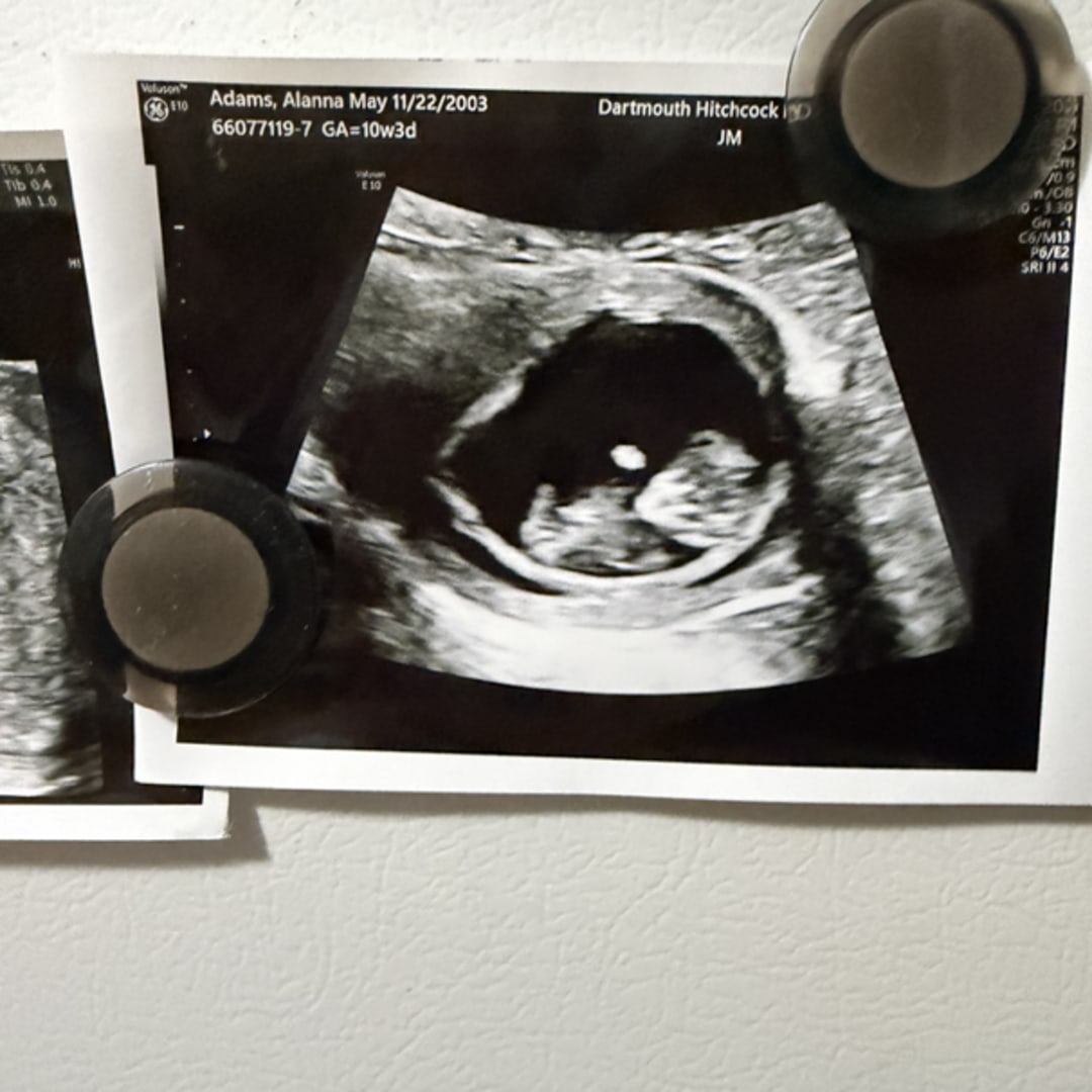 Photo shared by Alanna for their Babylist baby registry.