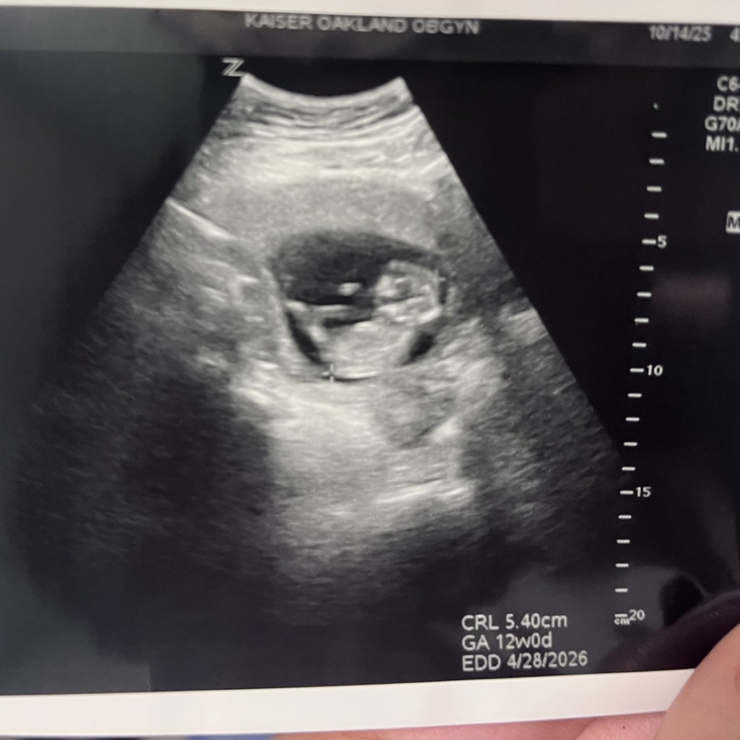 Photo shared by Megan for their Babylist baby registry.