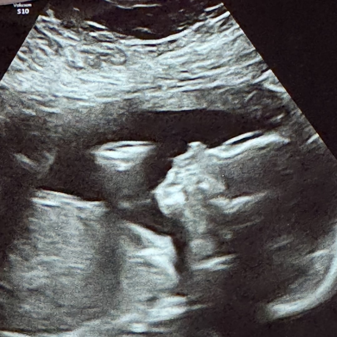 Photo shared by Angel for their Babylist baby registry.
