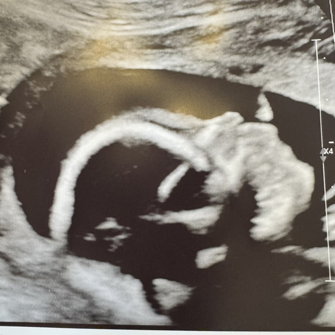 Photo shared by Brianna for their Babylist baby registry.