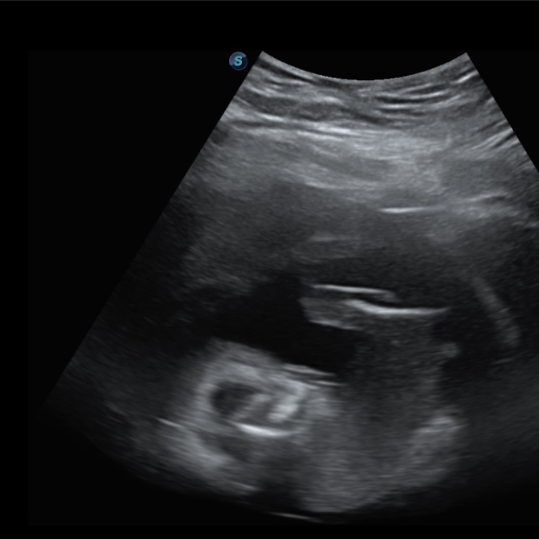 Photo shared by Ebony for their Babylist baby registry.