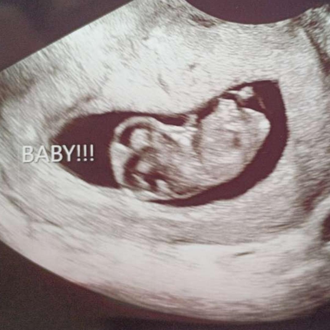 Photo shared by Cheyenne for their Babylist baby registry.